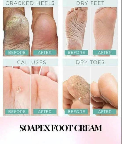 SOAPEX FOOT AND HANDS CRACKED SKIN REPAIR CREAM 75ml
